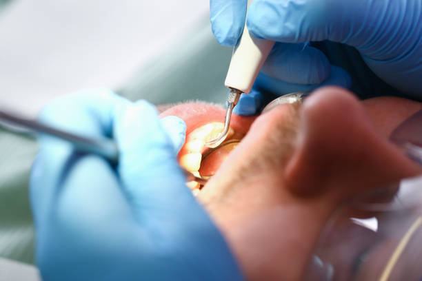 Best Cracked Tooth Emergency Dentist  in Smith Center, KS