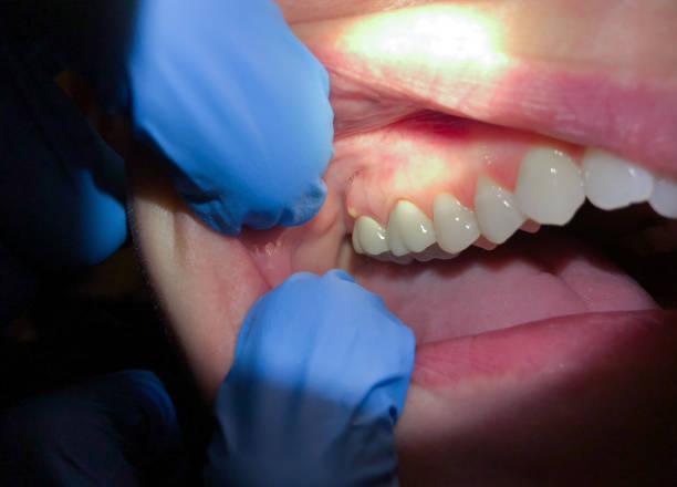 Best Tooth Infection Emergency Dentist  in Smith Center, KS